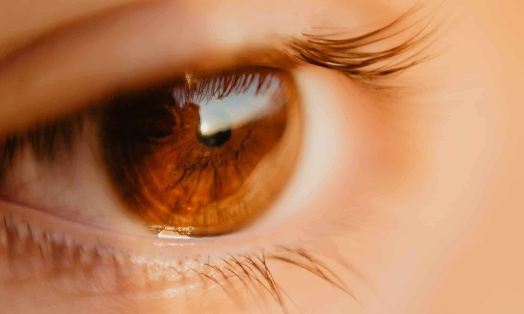 Bolest očí: Co může být příčinou a jak to léčit? 8
